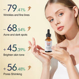 Rejuvenating Serum Repair To Remove Acne And Fade Acne Marks