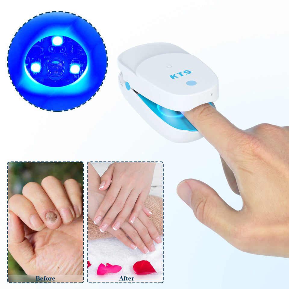 Fingernail Fungus Removal Light Therapy Treatment LLLT Nail